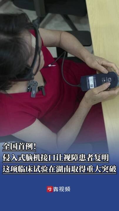 全国首例侵入式脑机接口让失明 20 年患者重见光明
